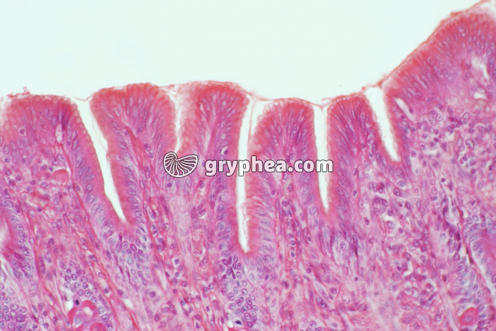 Muqueuse gastrique x100 - gryphea.org